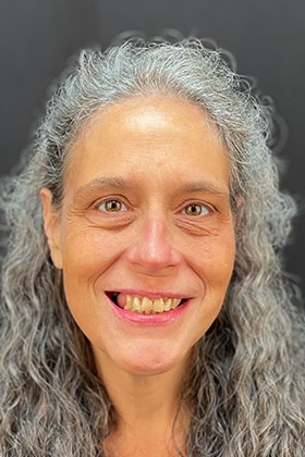 Before and after smile transformation by Advanced Dental Implant and TMJ Center in Southaven, MS.